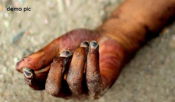 लातेहार में चलती ट्रेन से लडकी को फेंका, मौत लातेहार में चलती ट्रेन से लडकी को फेंका, मौत