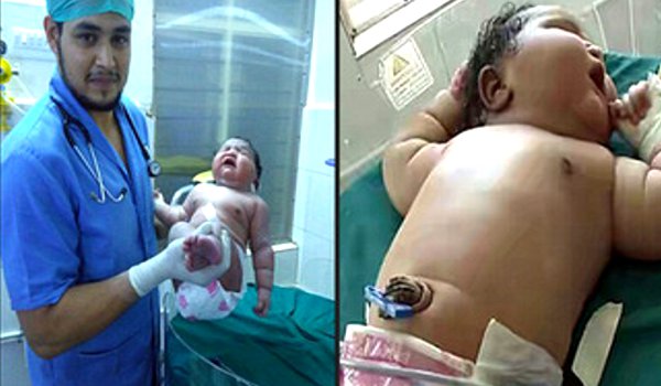 इस नवजात बच्ची ने जन्मते ही रच दिया इतिहास, वजन 6.82 किलोग्राम