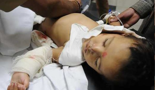 पाक गोलीबारी की बर्बरता का जीता-जागता सबूत है परी पाक गोलीबारी की बर्बरता का जीता-जागता सबूत है परी