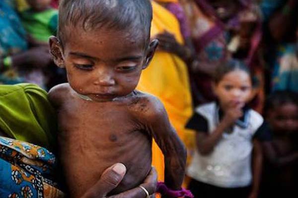 नाइजीरिया में भूख से मर सकते हैं 80 हजार बच्चे: यूनिसेफ