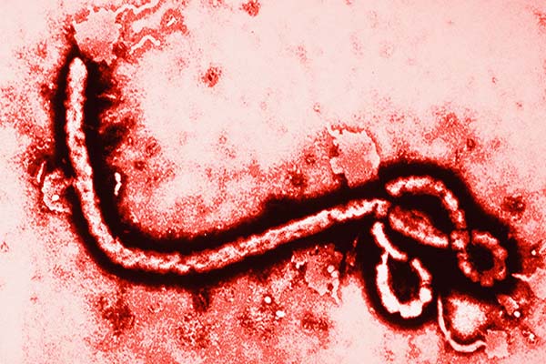 इबोला वायरस से फेफड़ों पर पड़ सकता है गहरा प्रभाव