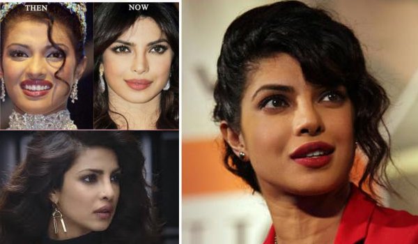 प्रियंका चोपड़ा ने खारिज की नाक की सर्जरी से जुड़ी अफवाह प्रियंका चोपड़ा ने खारिज की नाक की सर्जरी से जुड़ी अफवाह