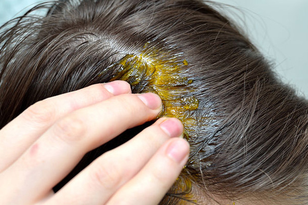 hair fall solution in hindi