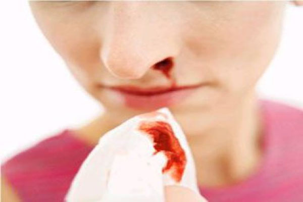 These remedies on bleeding from the nose