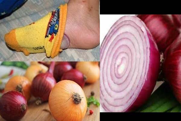 keep onion in shocks in night for health benefits