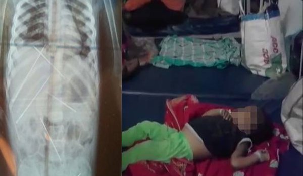 3 Year Old Girl Tortured With Needles Dies In Kolkata Hospital