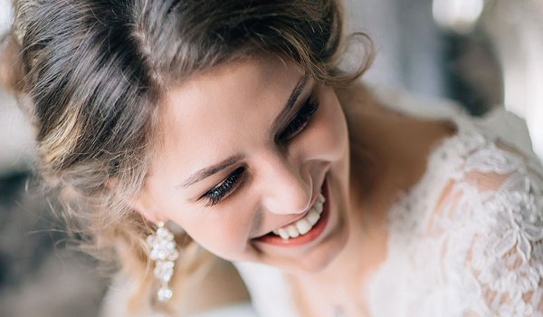 शादी के मौके पर दांतों को यूं बनाएं सफेद, चमकदार!