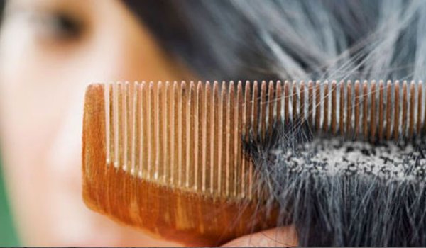 Women's hair loss signs of tumors!