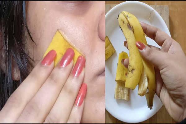 Banana peels are rid of pimples stains