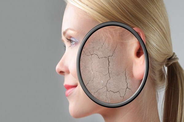 Do these home remedies to remove the stench of skin in the winter