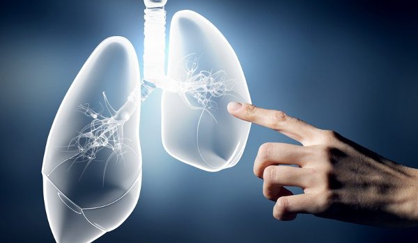 Stem cell transplants bring new hope for lung patients
