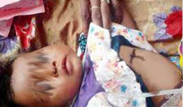 4 year old girl branded iron rod in bhilwara, grandfather Arrested
