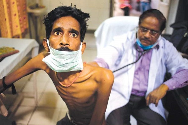 India goal of getting TB free by 2025