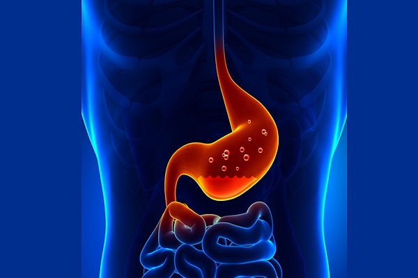 OMG Acidity is a serious problem it is possible to get rid of the home remedies
