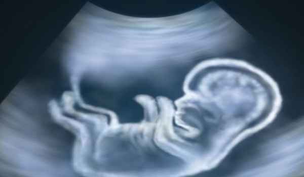 Three held by pcpndt cell for sex determination test in udaipur