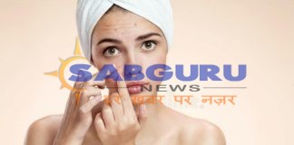 baidyanaath Ayurvedic medicines surakt for the nail-acne