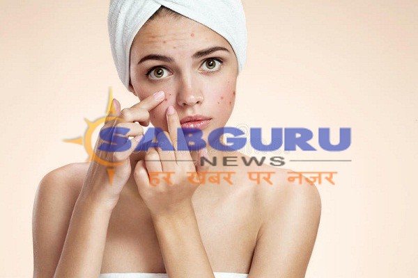 baidyanaath Ayurvedic medicines surakt for the nail-acne