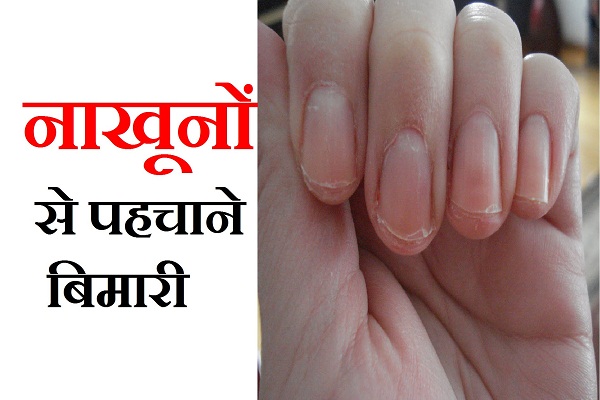 secret of your health through nails