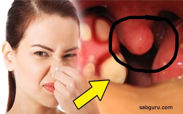 mouth smell bad