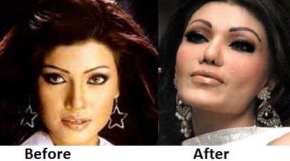 Koena Mitra Before and After