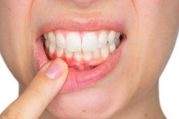 Pyorrhea impedes diabetes control, also risk of heart disease