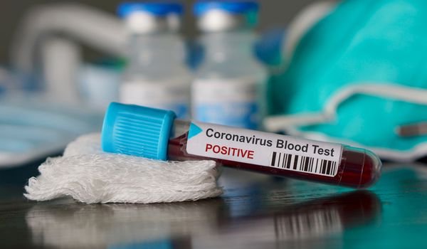 210 deaths in corona infected in Madhya Pradesh and Maharashtra