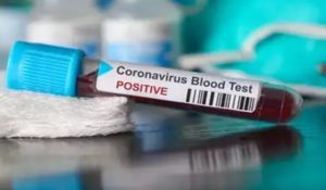 Corona case crosses 99000 in delhi