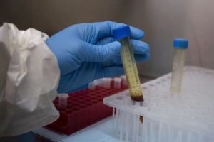 coronavirus update rajasthan recorded 480 fresh covid 19 positive cases total number rises to 19532