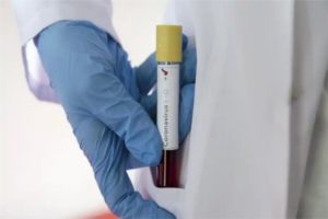 coronavirus update bhopal recorded 190 fresh covid-19 positive cases