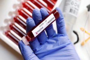 coronavirus update bhopal recorded 153 fresh covid 19 positive cases