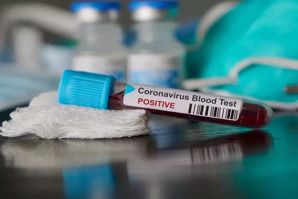 coronavirus update