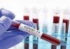 coronavirus update india recorded 16504 fresh covid-19 positive cases in 24 hours