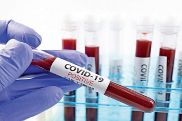 coronavirus update india recorded 16504 fresh covid-19 positive cases in 24 hours