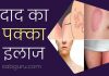 daad-ka-pakka-ilaj-ayurvedic treatment for fungal infection