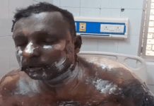 मुरादाबाद में आग की लपटों से घिरा युवक सड़क पर दौड़ा