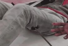 सड़क हादसे में युवक की जांघ में फंसा सरिया, 225 किमी दूर भोपाल रेफर