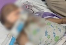 भिवाड़ी में महिला ने मायके न भेजे जाने से रुष्ट होकर मासूम बालिका को पिलाया तेजाब