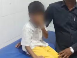 वाराणसी में छात्र का निजी अंग जलाने के आरोप में शिक्षिका पर पॉक्सो की अतिरिक्त धाराएं जोड़ी गईं