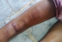 सात साल के बच्चे को शिक्षक ने नृशंसता से पीटा, शिक्षक के खिलाफ प्रकरण दर्ज
