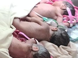 अलवर के सरकारी अस्पताल में महिला ने एक साथ तीन बेटियों को जन्म दिया