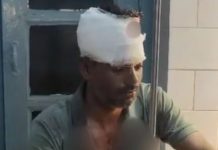 भिण्ड में पेट्रोल पंप कर्मचारी को सिर में गोली मारकर घायल किया, ग्वालियर रेफर